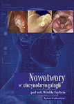 Nowotwory w otorynolaryngologii