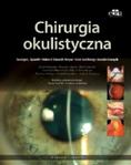 Chirurgia okulistyczna