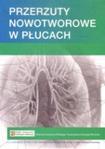 Przerzuty nowotworowe w płucach