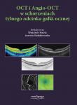 OCT i Angio-OCT w schorzeniach tylnego odcinka gałki ocznej