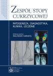 Zespół stopy cukrzycowej Patogeneza, diagnostyka, klinika, leczenie