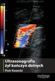 Ultrasonografia żył kończyn dolnych