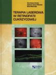 Terapia laserowa w retinopatii cukrzycowej