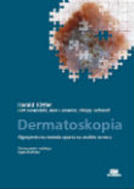 G-dermatoskopia-algorytmiczna-metoda-oparta-na-analizie-wzorca_10638_150x190