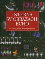 G-interna-w-obrazach-echo_7844_150x190